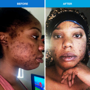 before aftervitme